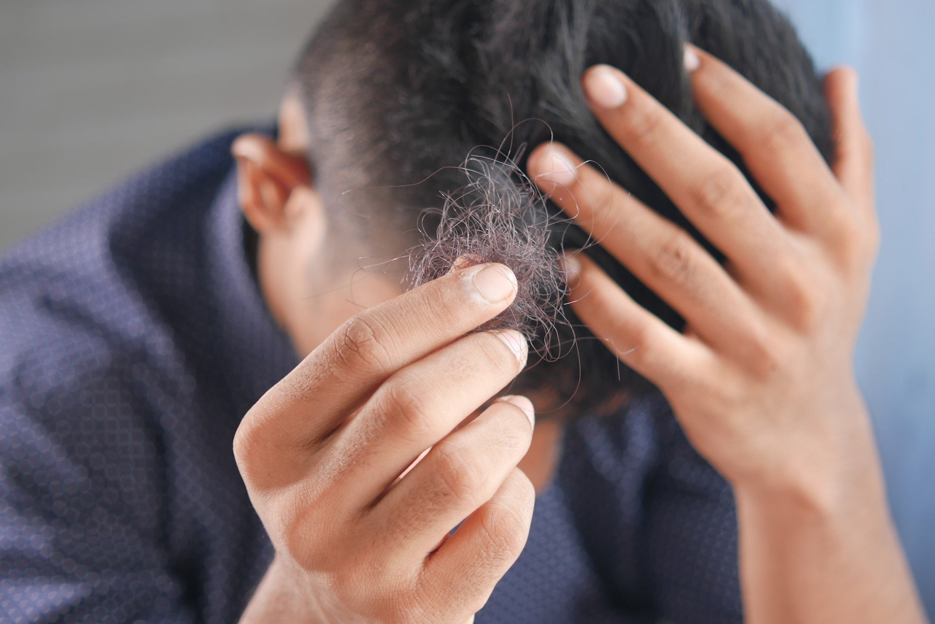 What to Know Before Using Pyrilutamide